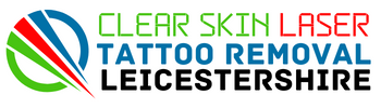 laser tattoo removal leicester