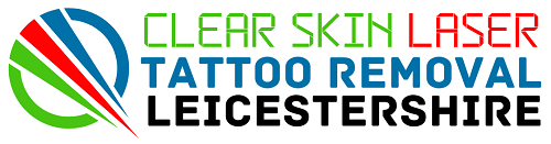 Laser Tattoo Removal Leicester