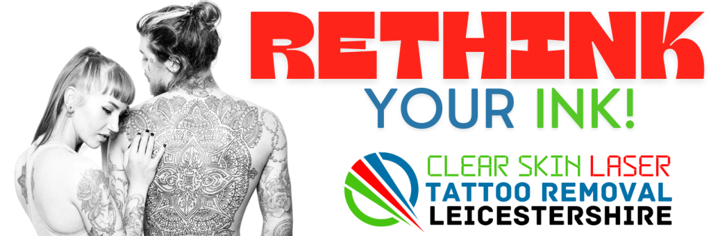 Tattoo Removal Leicester